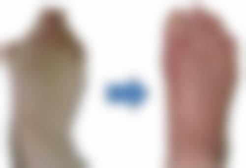 影响大腿抽脂瘦多少厘米的因素：多方面因素大揭秘