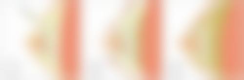 吴国兴义齿修复实例