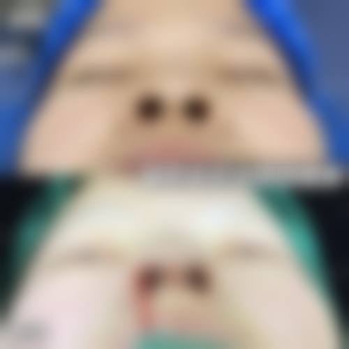 金圣浩眼部整形水平怎么样可靠吗？