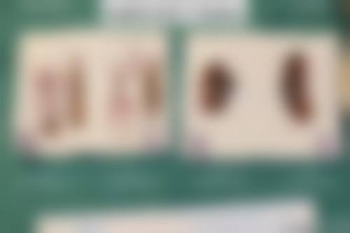 夏安香私密整形水平怎么样可靠吗？