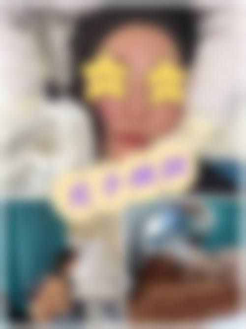 张儒庆光子嫩肤美白实例