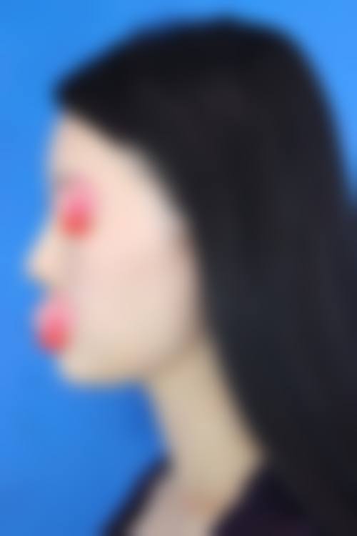 金钟瑞韩式隆鼻水平怎么样可靠吗？