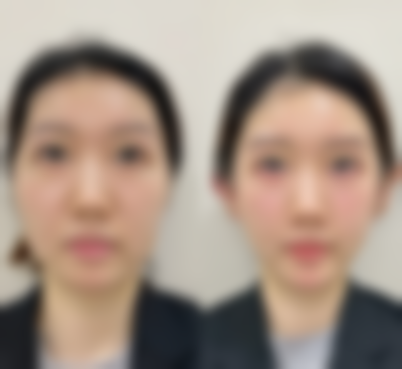 五、成都武侯渼淳玉颜整形医疗美容实例