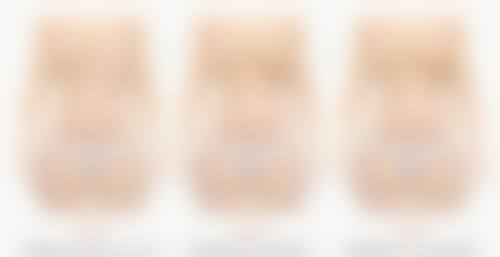 轻松告别熬夜眼袋！医美改善方案，针对性解决问题