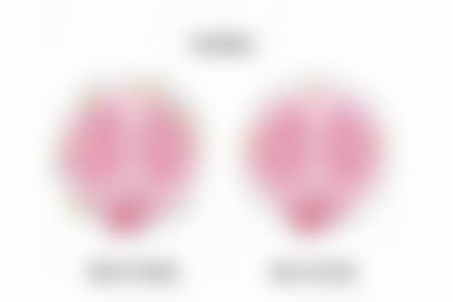 快速消除眼袋淤青，注意事项要牢记