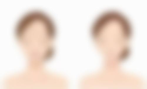 七、北海维纳斯医疗美容诊所价格表：（仅供参考）