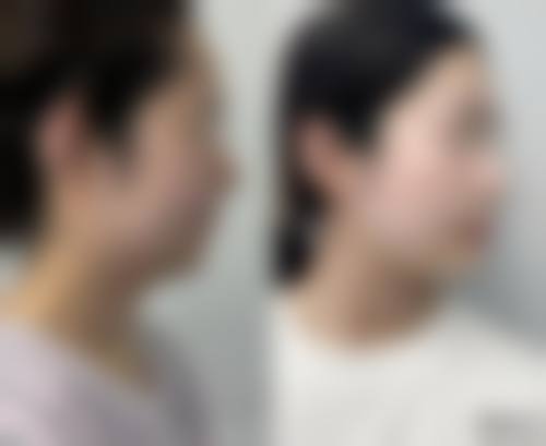 王艳成面部常规手术水平怎么样可靠吗？