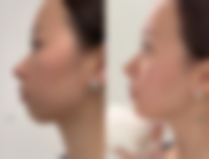 五、呼和浩特悦美云裳整形医院怎么预约：