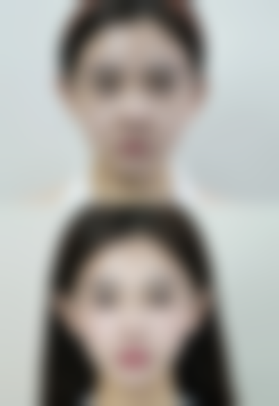 假体隆胸破裂是否有感觉？正规医院专精解决之道