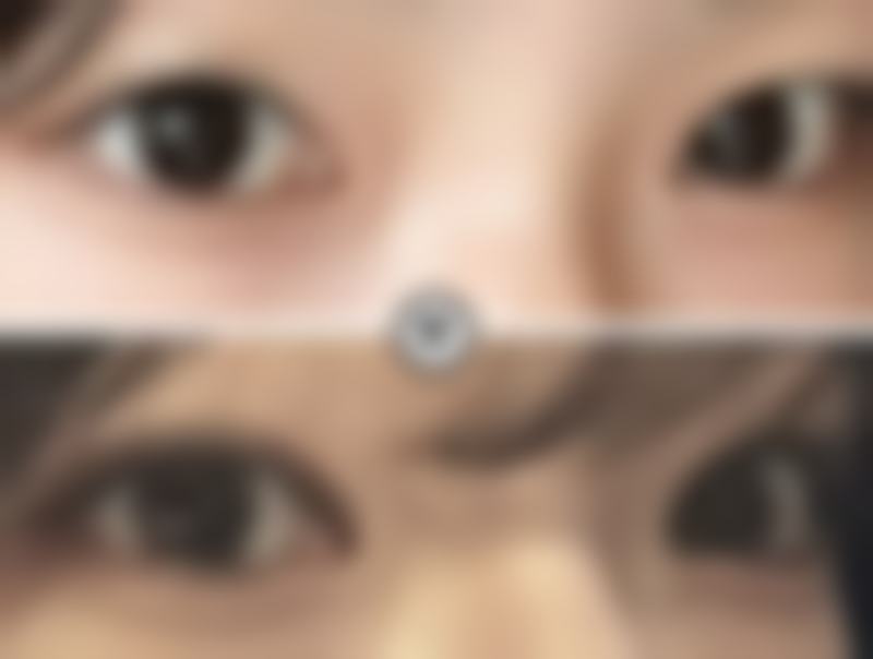 张科军眼部整形水平怎么样可靠吗？