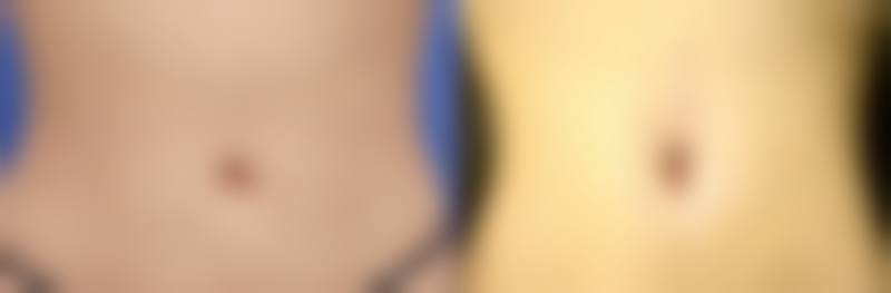 八、北海维纳斯医疗美容诊所真实的顾客评价如下：