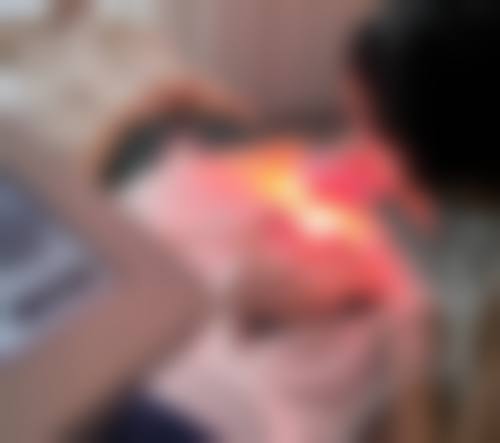 张儒庆怎么预约？