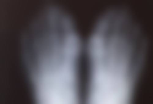 了解婴儿烫伤疤痕增生的发展过程