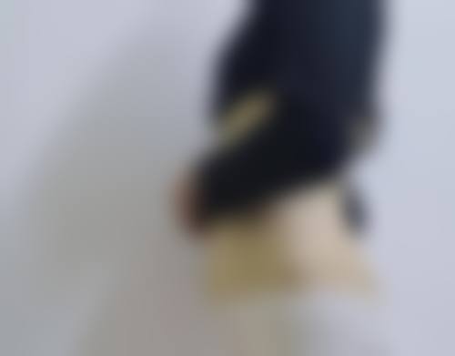 赵世平面部微整形实例