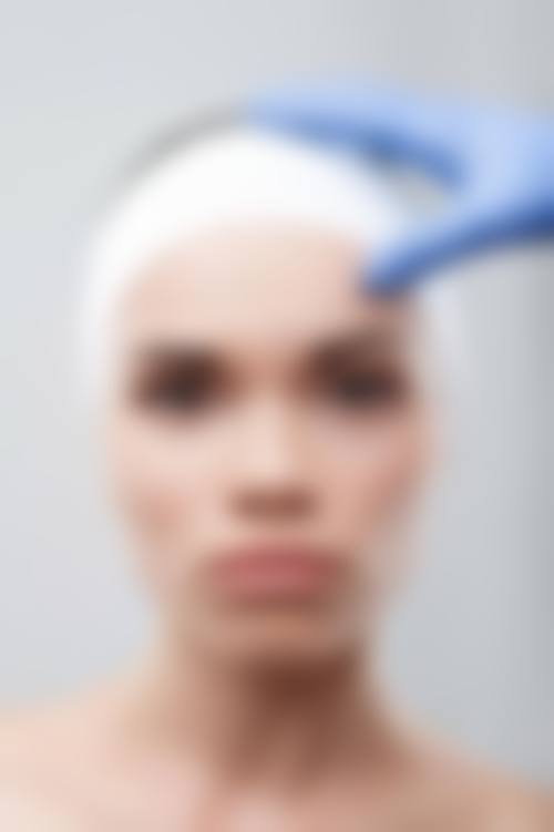 郭长元面部除皱水平怎么样可靠吗？