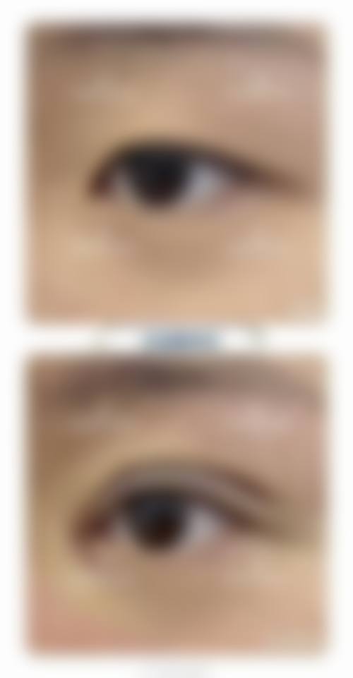 齐小玲韩式美容水平怎么样可靠吗？