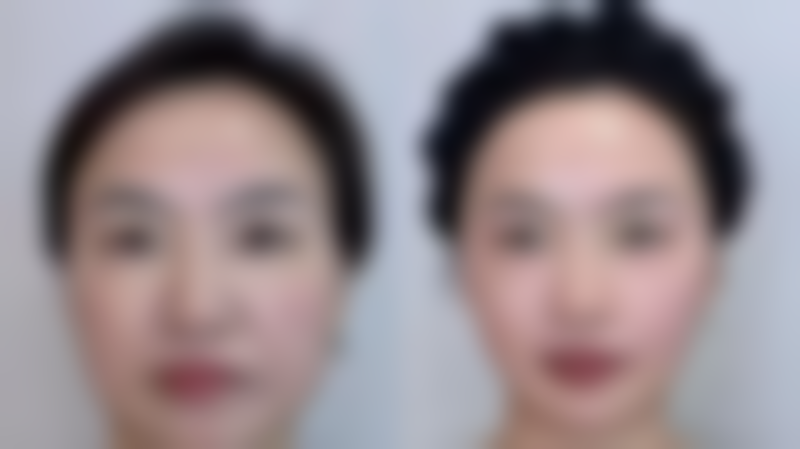 六、淄博春之樱整形医院价格表：（仅供参考）