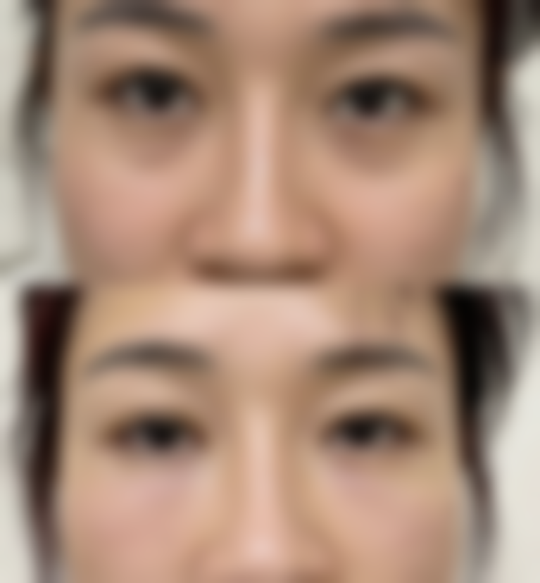 药流后的注意事项与管理