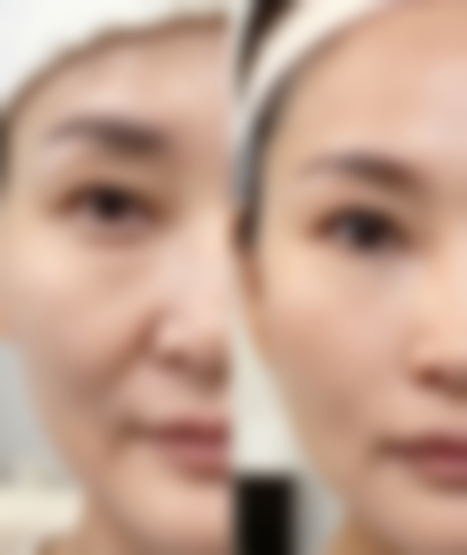 七、淄博春之樱整形医院真实的顾客评价如下：