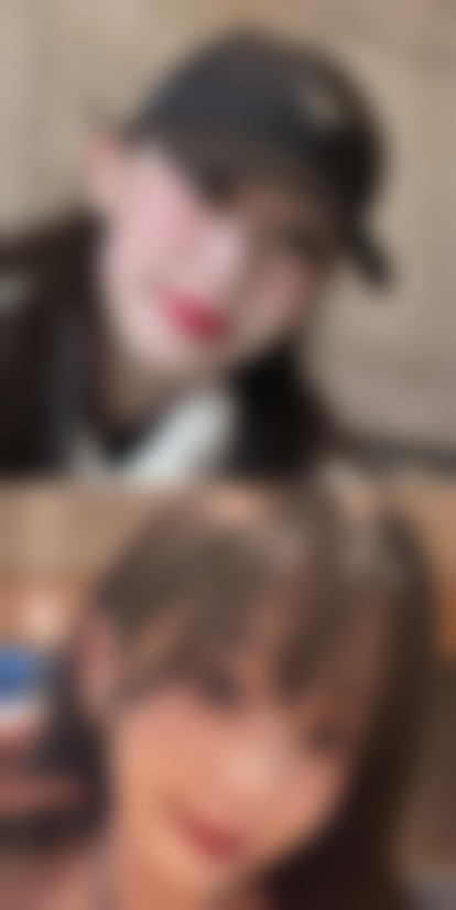 促进婴儿烫伤疤痕增生消除的科学护理方法