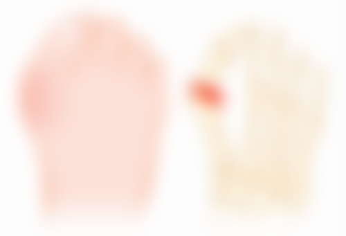 下眼袋肿胀消除有妙招！结合日常护理与医美方案，逐步改善眼周状态