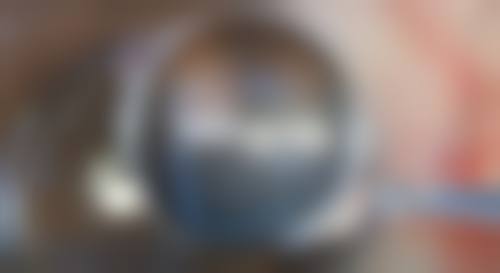 摆脱脚上抠痕烦恼，分阶段联合治疗方案