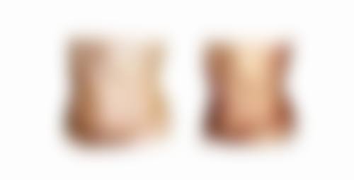 严格忌口助力快速修复