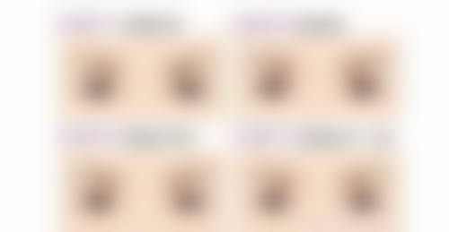 盛飞眼部综合整形水平怎么样可靠吗？