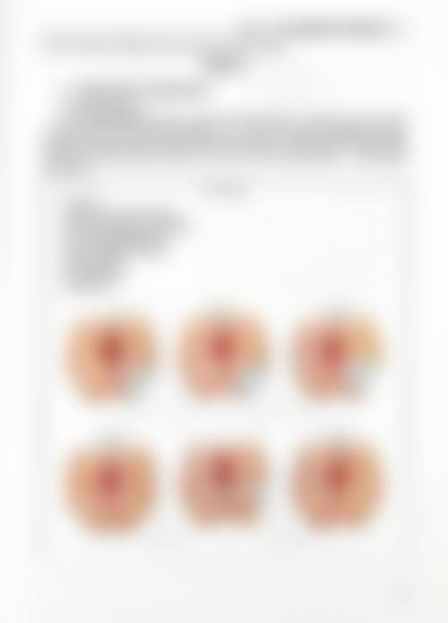 夏安香私密整形实例