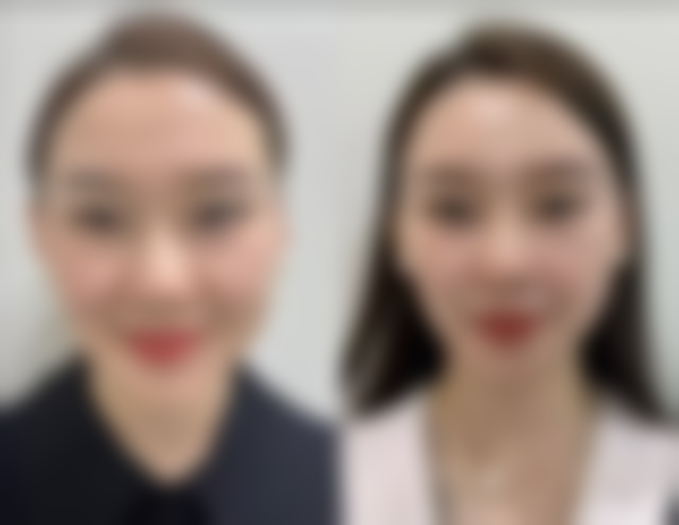 李承赭皮肤美容水平怎么样可靠吗？