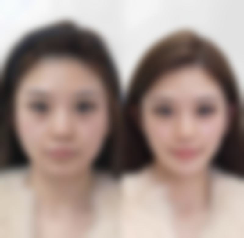 四、成都华生铂悦医疗美容整形门诊部实例