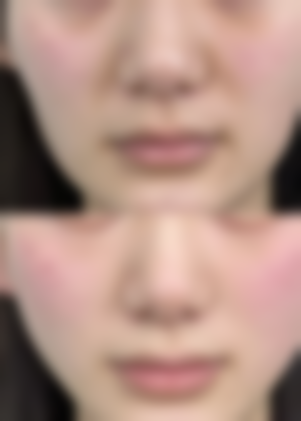 陈是富牙体修复项目价格表参考