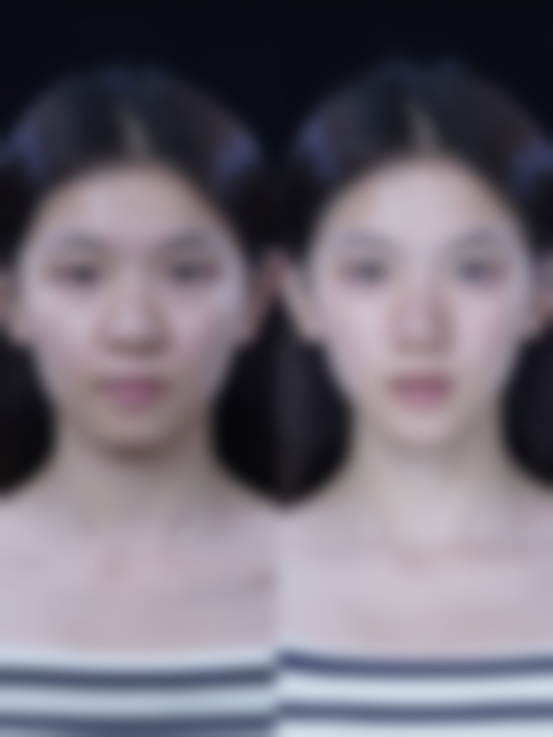 告别眼部眼袋与黑色素困扰，保持良好心态和作息