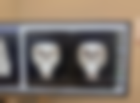 六、西安医学校附属宝鸡医院(皮肤美容科)价格表：（仅供参考）