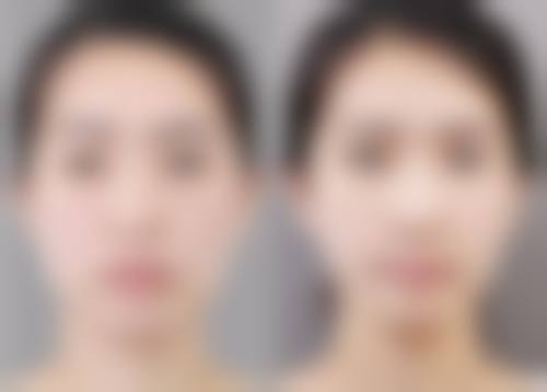 齐小玲韩式美容水平怎么样可靠吗？