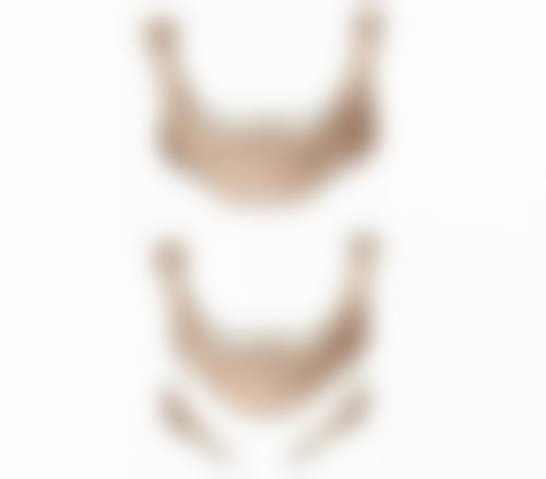 双眼皮手术可修复！选择专精医生特别重要