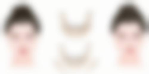 抽脂手术风险揭秘：正规医院优势多，助您安心塑身