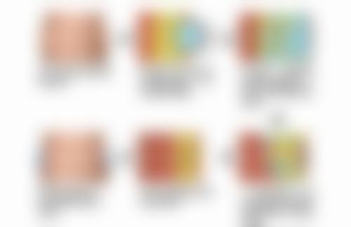 凹陷性疤痕修复有保护！专精医院实力大展示