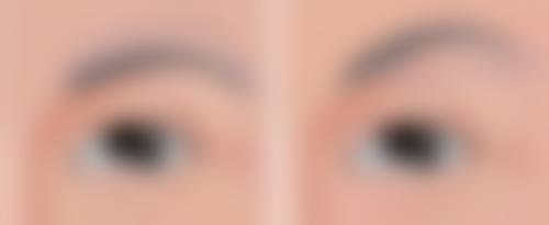 割双眼皮后喝咖啡的替代饮品：多样选择助修复