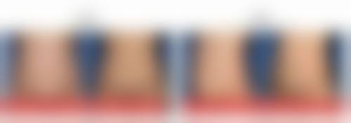 六、厦门思明四季木兰整形医院怎么预约：