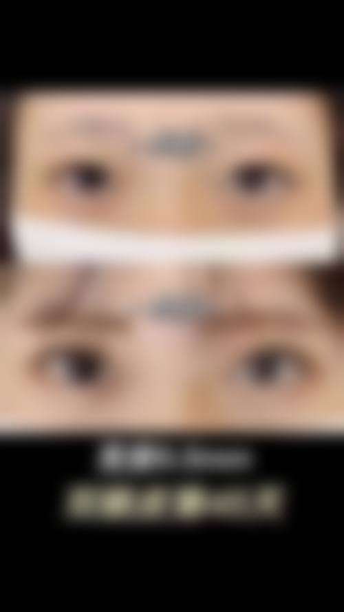 齐小玲韩式美容实例