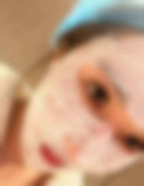 张儒庆光子嫩肤美白实例