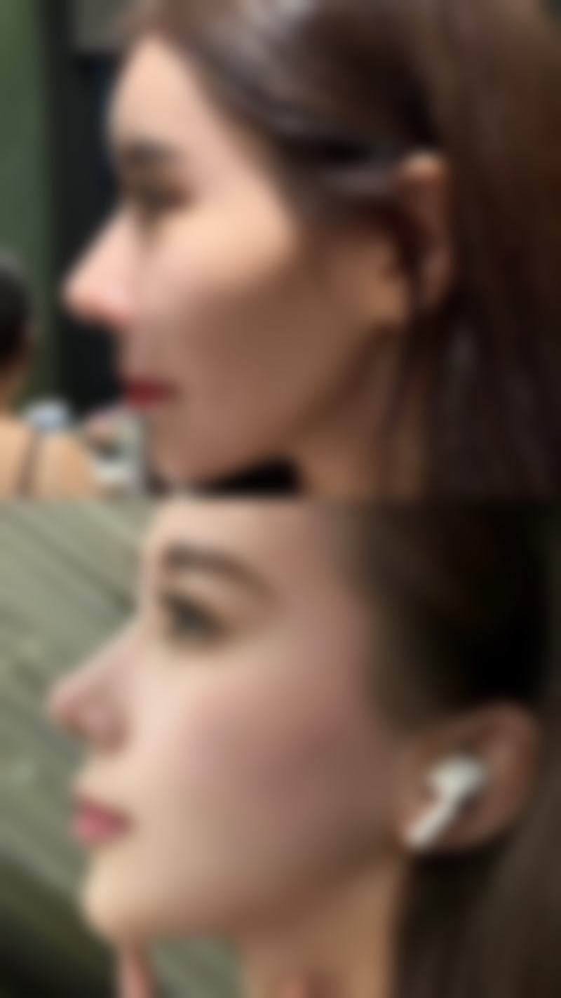 齐小玲项目价格表参考