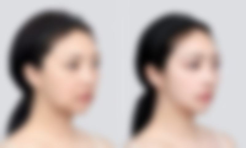 章纯忠面部五官整形水平怎么样可靠吗？