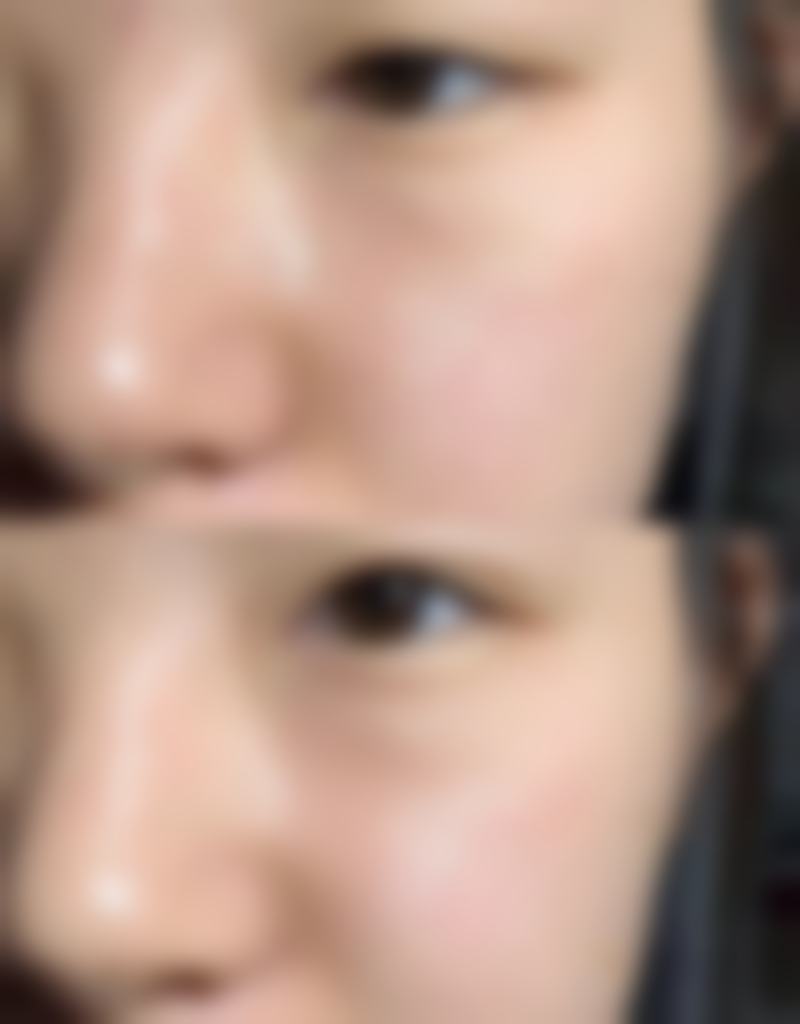 郭长元面部除皱水平怎么样可靠吗？