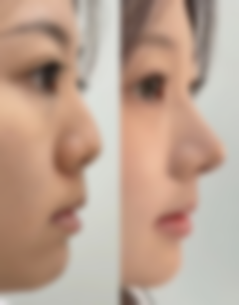 章纯忠面部五官整形实例