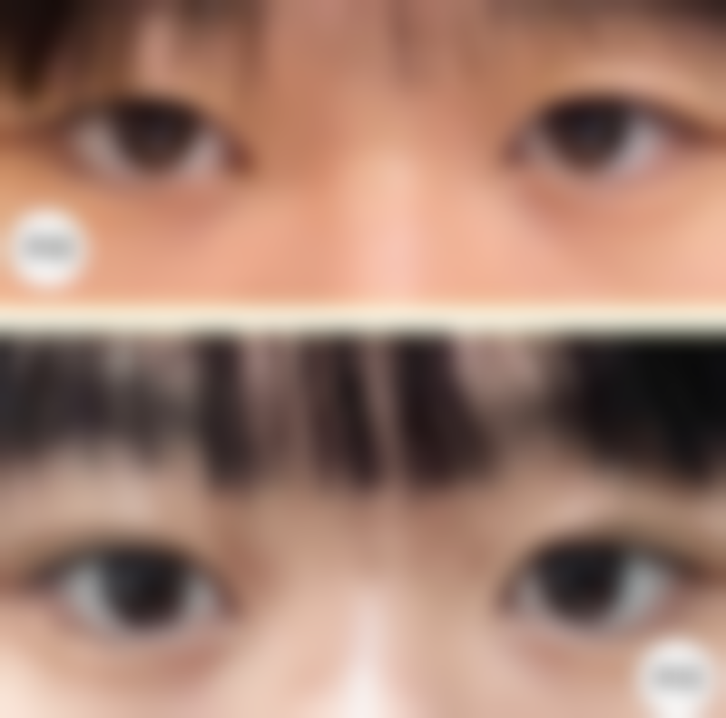 工伤面部留疤别怕！多种医疗手段助修复，还有赔偿申请和日常护理指南