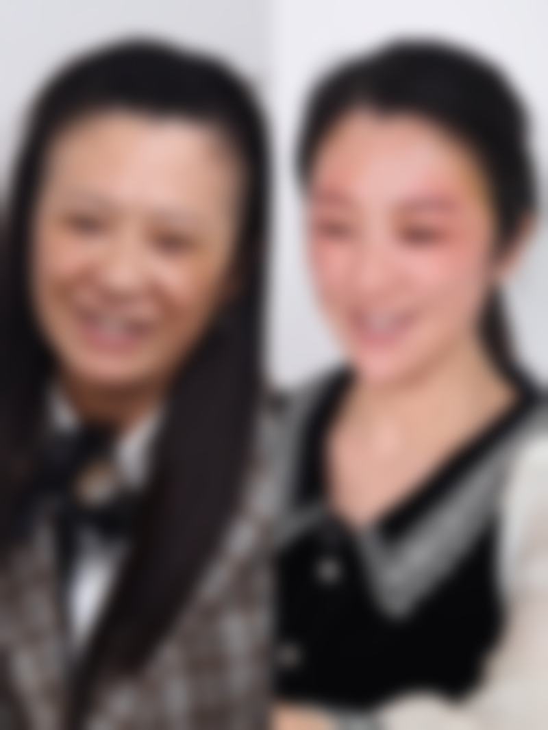 痘痘留疤不用愁！正规医院多手段改善，结合日常护理还你光滑美肌 