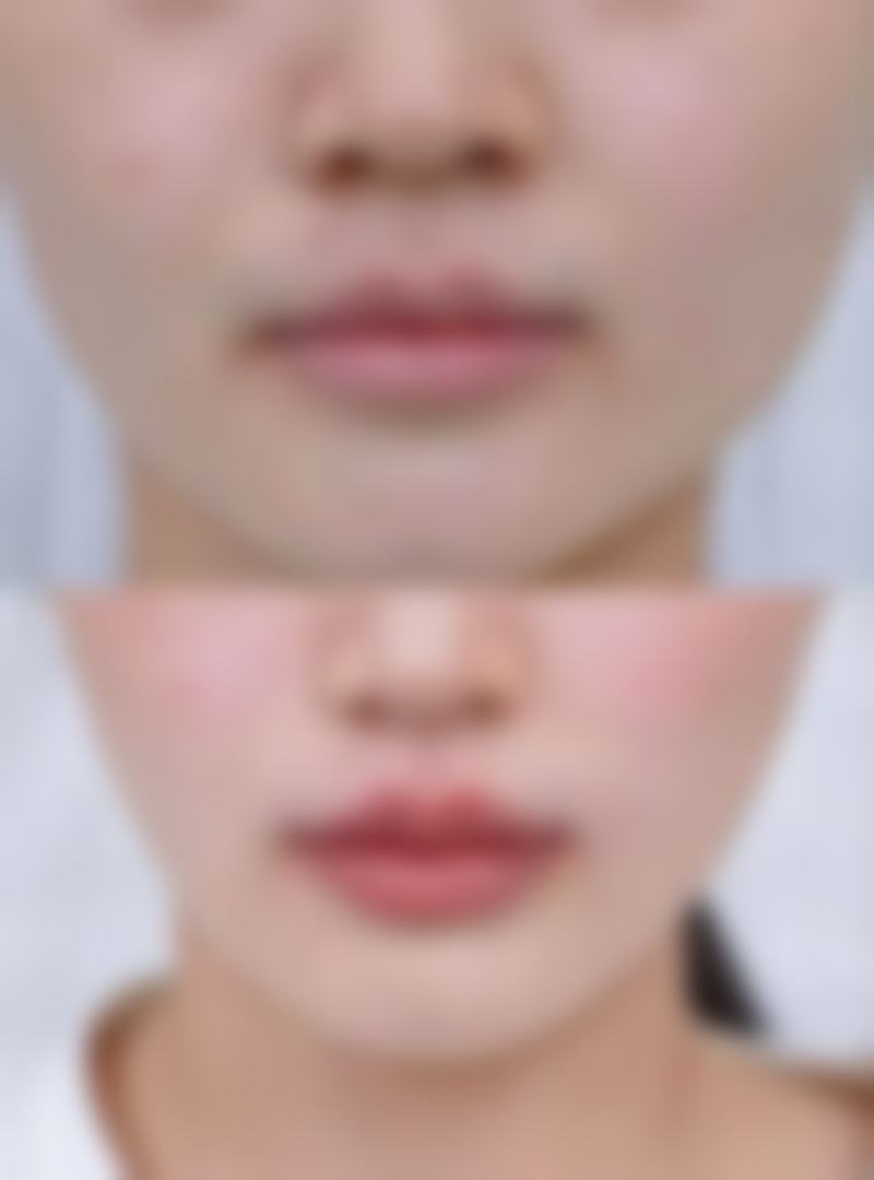 七、南京美立方整形美容医院真实的顾客评价如下：