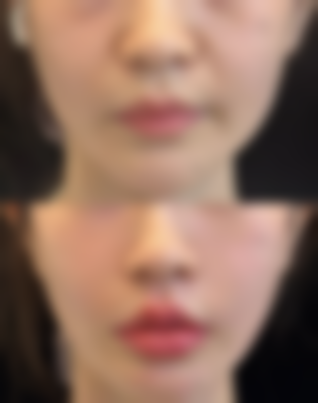 郭长元项目价格表参考